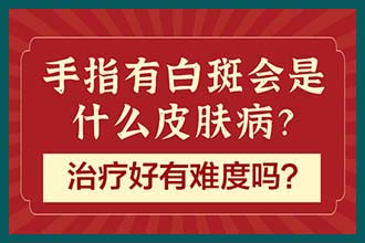 白癜风治疗昆明哪个医院好，小孩白癜风面部应该如何护理的要点